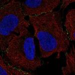 MAGI3 Antibody in Immunocytochemistry (ICC/IF)