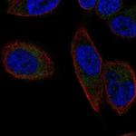 SLC25A23 Antibody in Immunocytochemistry (ICC/IF)