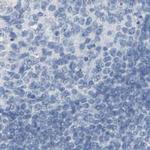 Opsin Blue Antibody in Immunohistochemistry (IHC)