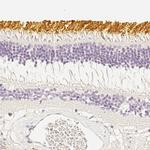 Opsin Blue Antibody in Immunohistochemistry (IHC)