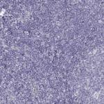 Aquaporin 0 Antibody in Immunohistochemistry (Paraffin) (IHC (P))