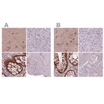 Sorcin Antibody in Immunohistochemistry (IHC)