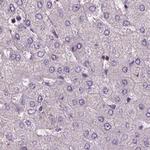 Sorcin Antibody in Immunohistochemistry (IHC)