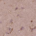 Sorcin Antibody in Immunohistochemistry (IHC)