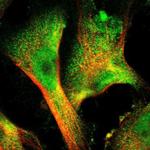 Sorcin Antibody in Immunocytochemistry (ICC/IF)