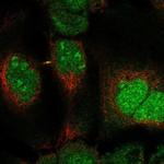 DUSP11 Antibody in Immunocytochemistry (ICC/IF)