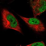 DSCC1 Antibody in Immunocytochemistry (ICC/IF)