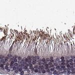 RP1L1 Antibody in Immunohistochemistry (IHC)