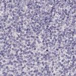 RP1L1 Antibody in Immunohistochemistry (IHC)