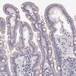 RP1L1 Antibody in Immunohistochemistry (IHC)