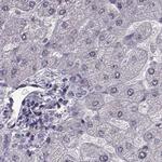 RP1L1 Antibody in Immunohistochemistry (IHC)