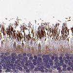 RP1L1 Antibody in Immunohistochemistry (IHC)