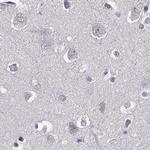 RP1L1 Antibody in Immunohistochemistry (IHC)