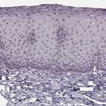 RP1L1 Antibody in Immunohistochemistry (IHC)