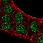 ATOH8 Antibody in Immunocytochemistry (ICC/IF)