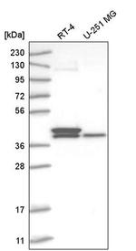 TFB2M Antibody in Western Blot (WB)