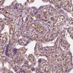 HTR1B Antibody in Immunohistochemistry (IHC)