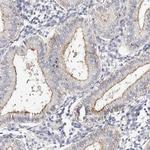 ROM1 Antibody in Immunohistochemistry (Paraffin) (IHC (P))