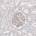 ROM1 Antibody in Immunohistochemistry (Paraffin) (IHC (P))