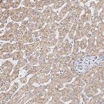 ROM1 Antibody in Immunohistochemistry (Paraffin) (IHC (P))