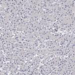 ROM1 Antibody in Immunohistochemistry (Paraffin) (IHC (P))