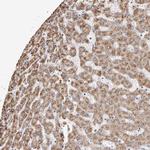 ROM1 Antibody in Immunohistochemistry (IHC)