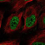 RAD52 Antibody in Immunocytochemistry (ICC/IF)