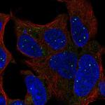 TBX1 Antibody in Immunocytochemistry (ICC/IF)