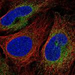 SCARA3 Antibody in Immunocytochemistry (ICC/IF)