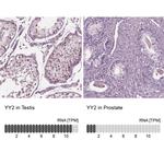 YY2 Antibody in Immunohistochemistry (IHC)