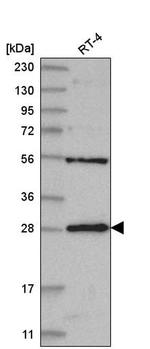 MED6 Antibody in Western Blot (WB)