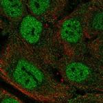 MTCP1 Antibody in Immunocytochemistry (ICC/IF)