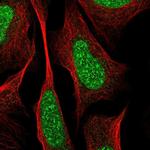 RREB1 Antibody in Immunocytochemistry (ICC/IF)