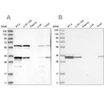 PACT Antibody in Western Blot (WB)