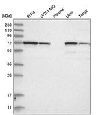 ATP6V1A Antibody in Western Blot (WB)