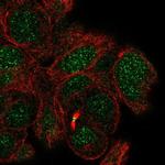 MBD5 Antibody in Immunocytochemistry (ICC/IF)