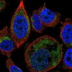 SLC25A16 Antibody in Immunocytochemistry (ICC/IF)