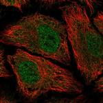 PDE8B Antibody in Immunocytochemistry (ICC/IF)