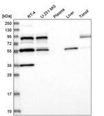 SFRS12 Antibody in Western Blot (WB)