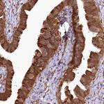 COPG Antibody in Immunohistochemistry (Paraffin) (IHC (P))