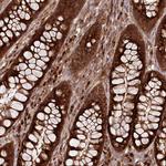 COPG Antibody in Immunohistochemistry (Paraffin) (IHC (P))