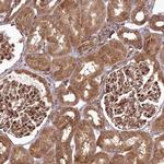 COPG Antibody in Immunohistochemistry (IHC)