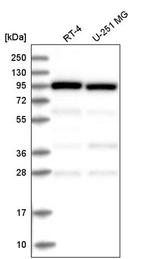 COPG Antibody in Western Blot (WB)