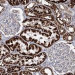 DHTKD1 Antibody in Immunohistochemistry (IHC)