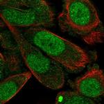 Syntaxin 2 Antibody in Immunocytochemistry (ICC/IF)