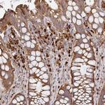 NADSYN1 Antibody in Immunohistochemistry (IHC)