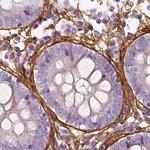 COL6A2 Antibody in Immunohistochemistry (IHC)