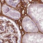 COL6A2 Antibody in Immunohistochemistry (IHC)