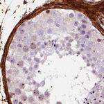 COL6A2 Antibody in Immunohistochemistry (IHC)