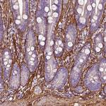 COL6A2 Antibody in Immunohistochemistry (IHC)